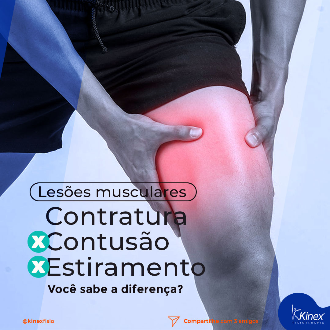 Mas afinal, é ou não é esporte? A definição acadêmica